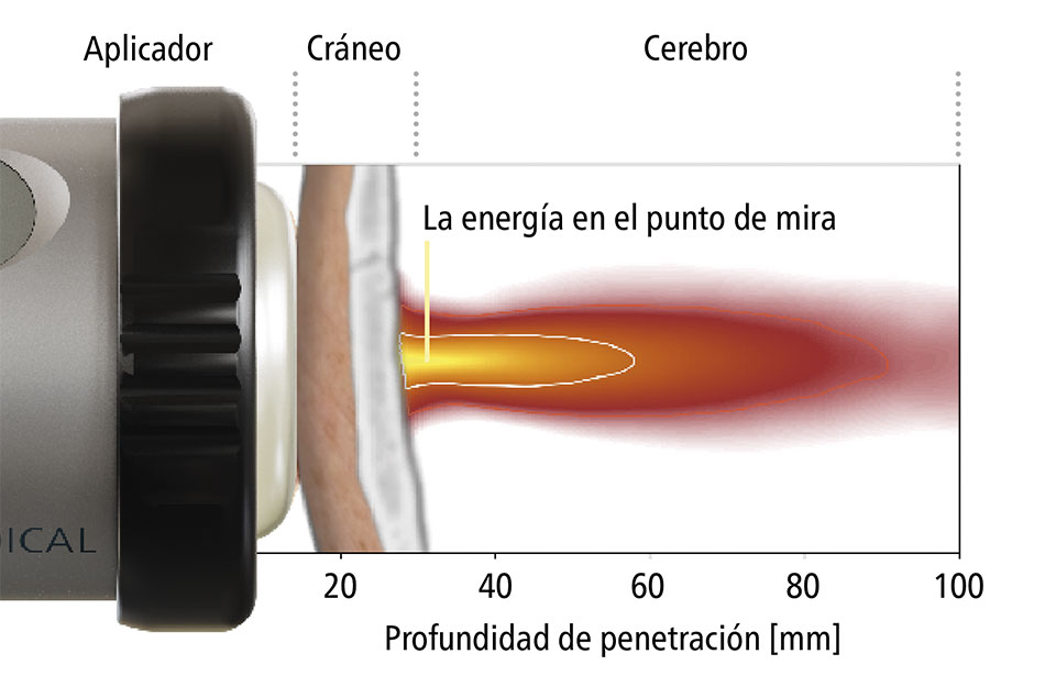 Profundidad de penetración