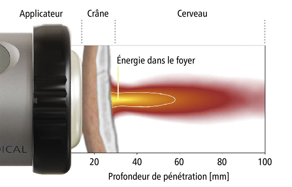 Profondeur de pénétration
